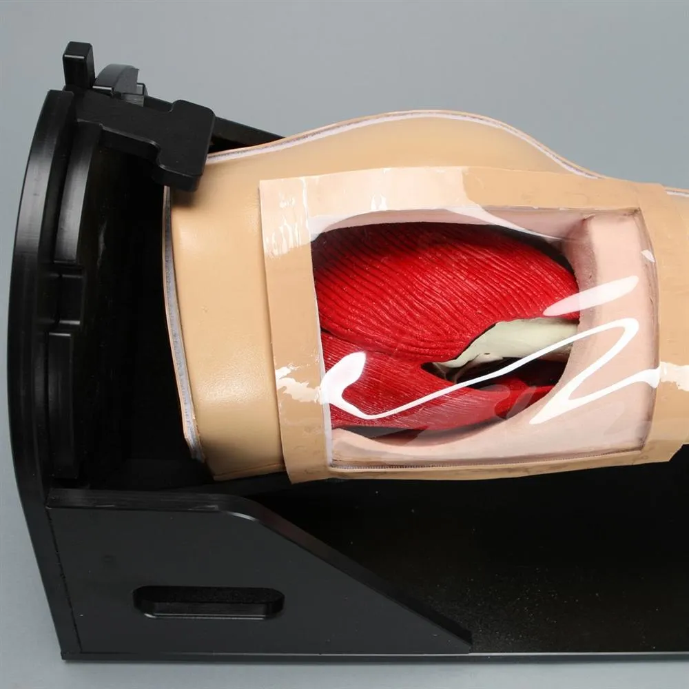 Arthroscopy Hip Model On Deluxe Stand